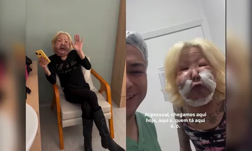 
							Influenciadora faz cirurgia após ter rosto deformado por procedimento
						
						