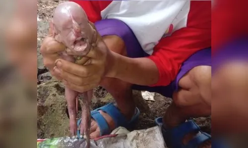 
							Leitão nasce com rosto de bebê humano; veja foto
						
						