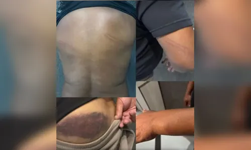 
							PM afasta policial que agrediu ex-jogador Perdigão no PR
						
						