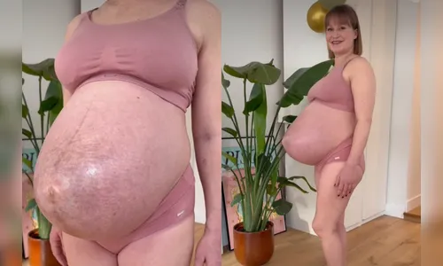 
							Grávida de trigêmeos chama atenção pelo formato incomum da barriga; veja foto
						
						