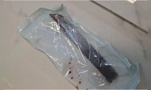 
							Mulher sobrevive após ter faca cravada no olho pelo companheiro em SC
						
						