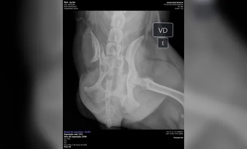 
							Cão de três patas atropelado em Apucarana precisa de ajuda para cirurgia
						
						