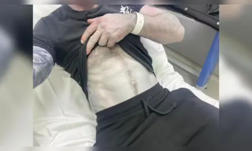 
							Homem se assusta ao acordar com pele azulada e diagnóstico surpreende
						
						