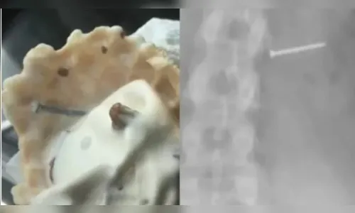 
							Mulher recebe indenização de R$ 74 milhões após sorvete causar infertilidade; entenda
						
						