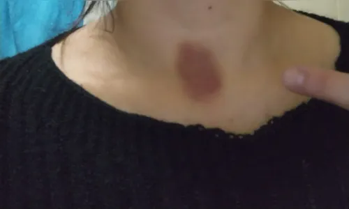 
							Advogada acusa PM de agressão e OAB realiza ato em Apucarana
						
						