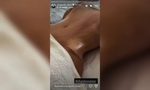 
							Mãe de Virginia impressiona ao exibir barriga reta um mês após cirurgia plástica; veja fotos
						
						