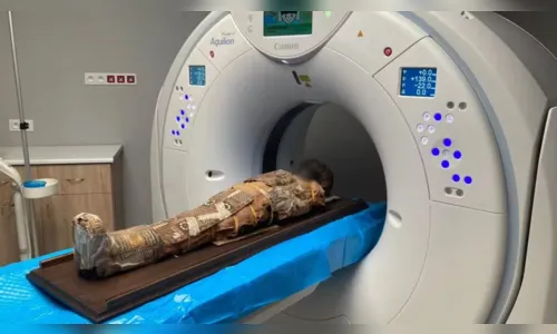 
							Objeto misterioso é identificado em múmia egípcia de criança de 8 anos; veja
						
						