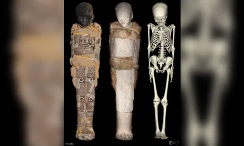 
							Objeto misterioso é identificado em múmia egípcia de criança de 8 anos; veja
						
						