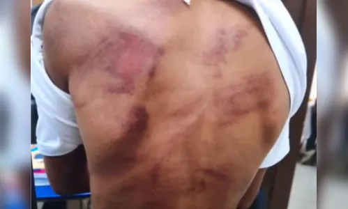 
							Homem é presos por suspeita de espancar filho de 9 anos; veja
						
						