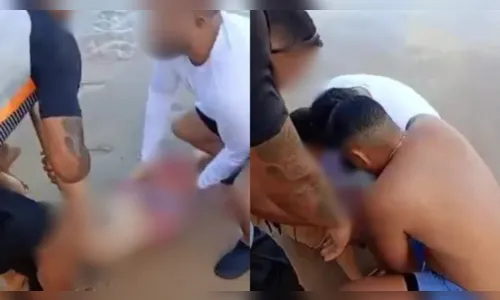 
							Jovem perde perna após ataque de tubarão em praia; vídeo registra pânico
						
						