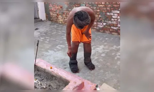 
							Homem passa 12 anos de pé por sacrífico religioso e inchaço das pernas impressiona; veja vídeo
						
						
