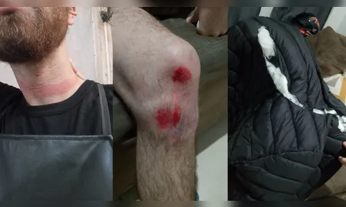 
							Caminhão arrasta fiação e provoca queda de motociclista em Apucarana
						
						