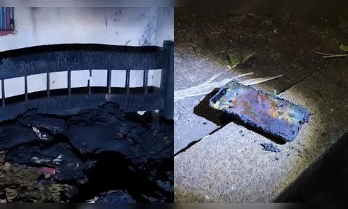
							Morador de Apucarana que sofreu queimaduras ao usar celular na tomada segue em estado grave
						
						
