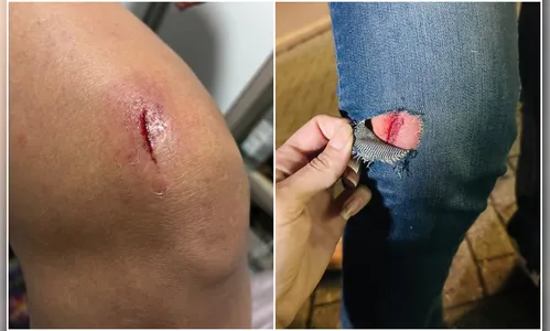 
							Motorista de aplicativo é investigado por agredir e arrastar passageira pelos cabelos no PR
						
						