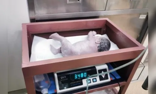 
							Mãe dá à luz à gêmeos com 10 anos de diferença, entenda
						
						