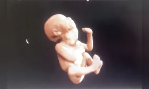 
							Recém-nascido passa por cirurgia considerada inédita no Paraná para tirar tumor do pescoço
						
						
