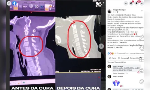 
							Apucaranense ferida em acidente na BR-369 segue hospitalizada
						
						