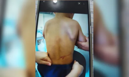 
						
							Menino de 4 anos sofre tortura e pais são presos; VÍDEO
						
						