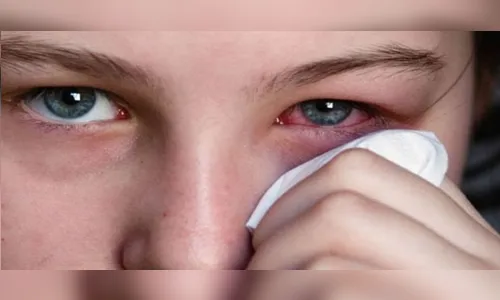 
						
							Descubra porque Oculax tem revolucionado o tratamento da medicina ocular
						
						