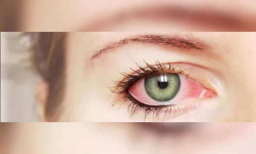 
						
							Descubra porque Oculax tem revolucionado o tratamento da medicina ocular
						
						
