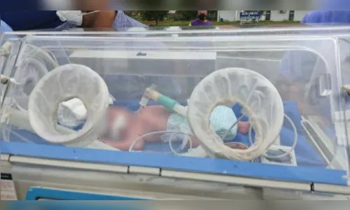 
						
							Médica grávida de 8 meses morre com Covid-19; bebê é salvo
						
						