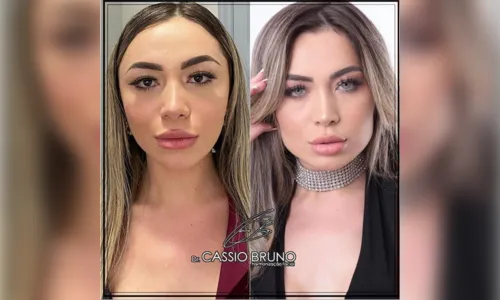 
							Dr. Cássio Bruno fala sobre o preenchimento de mandíbula
						
						