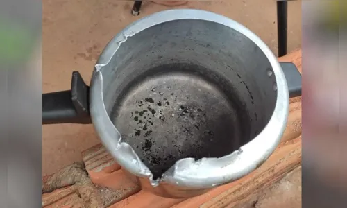 
							Menino de 2 anos prende cabeça em panela de pressão
						
						