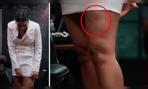 
							Atriz de 'Pantanal' diz que foi mordida por jacaré durante mergulho
						
						