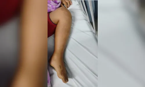 
							Criança é internada após confundir cobra com galho durante brincadeira
						
						