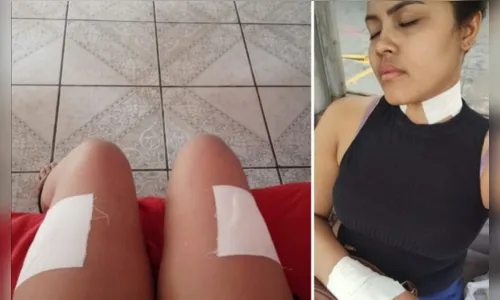 
						
							Golpe: mulher finge ter leucemia e recebe R$ 12 mil em doações
						
						