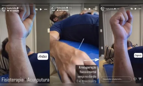 
						
							Kayky Brito mostra evolução após fisioterapia: 