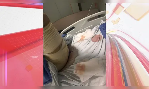 
							Mulher afirma que teve o clitóris cortado por médico famoso
						
						