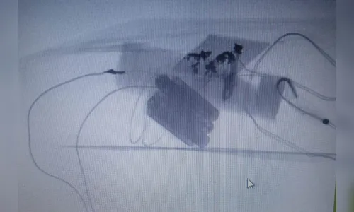
							Bomba é encontrada em terminal de ônibus do Paraná
						
						
