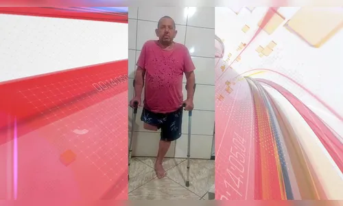
							Família pede ajuda para custear prótese de pai que perdeu a perna
						
						