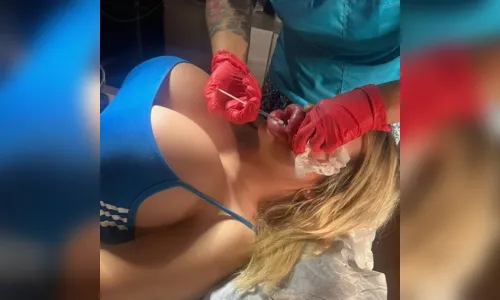 
							Influencer não consegue mais fechar a boca após preenchimentos labiais
						
						