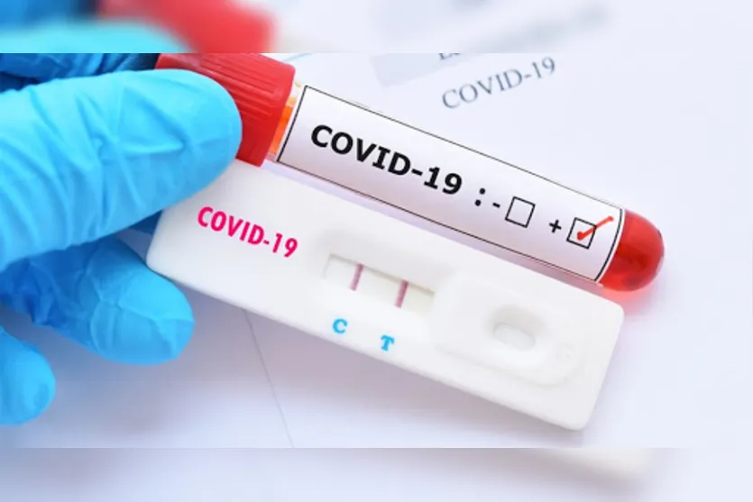 Mais sete casos de covid-19 são confirmados em São Pedro do Ivaí