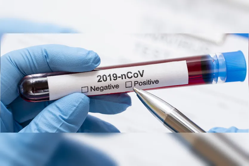 Lacen confirma mais 2 casos de coronavírus em Ivaiporã