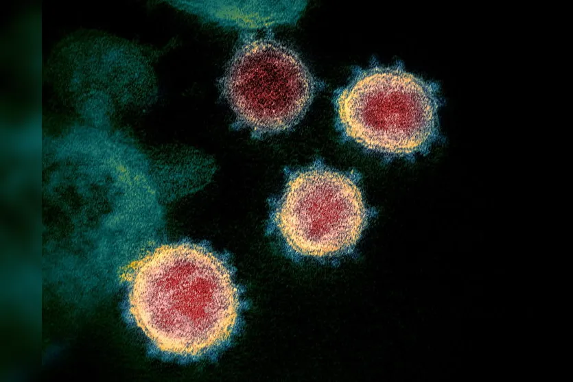 Arapongas confirma mais três mortes por coronavírus e novos 47 casos