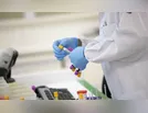 Ivaiporã tem mais cinco casos positivos de Covid-19 nesta quarta-feira (27 01)