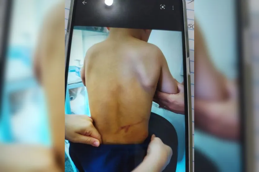 Menino de 4 anos sofre tortura e pais são presos; VÍDEO