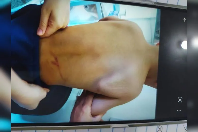 Polícia prende mãe que torturava filho com barra de ferro
