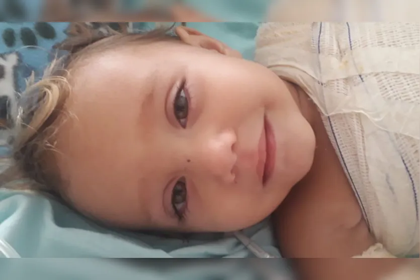 Bebê queimada em brincadeira com irmão vai receber alta