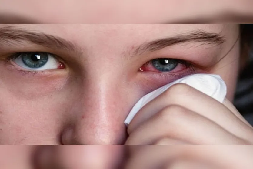 Descubra porque Oculax tem revolucionado o tratamento da medicina ocular