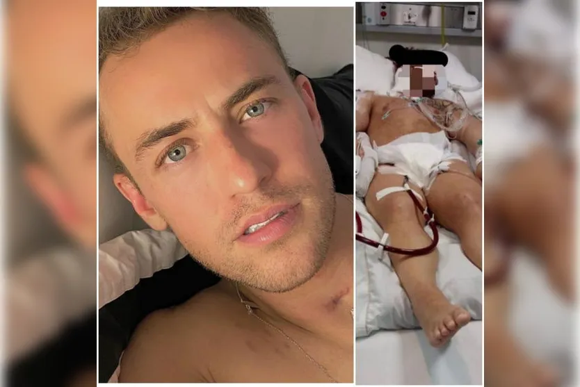 Jovem do PR que ficou 62 dias na UTI com Covid posta foto e viraliza