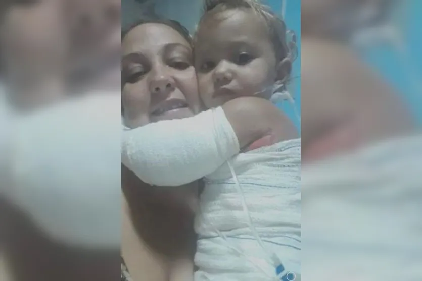 Mãe de criança queimada em brincadeira com irmão pede ajuda