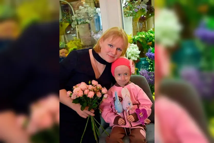 Com doença rara, garota de 10 anos morre 'de velhice'