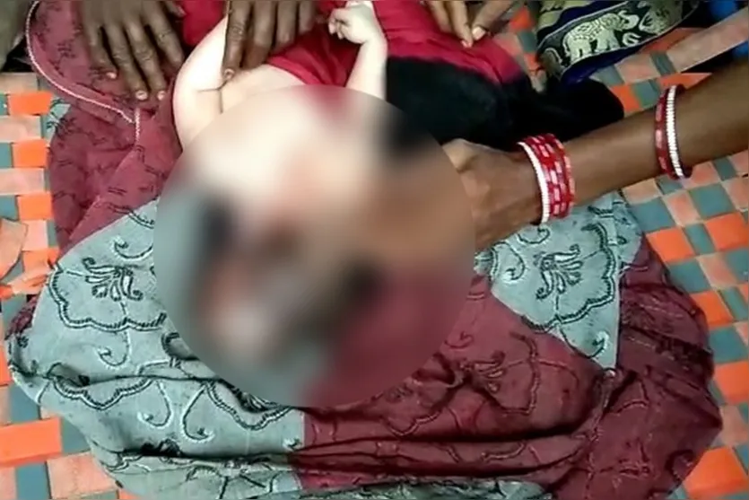 "Encarnação de Deus": bebê nasce com três cabeças na Índia