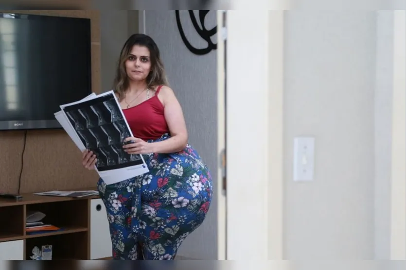 Mulher com tumor de 35 kg se prepara para cirurgia no PR
