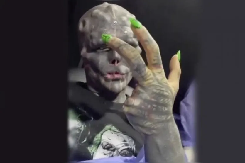 Homem tatuado amputa dedos para se parecer com alienígena