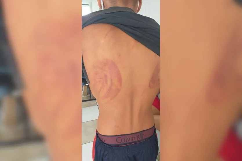 Adolescente é espancado pelo pai em Apucarana, diz GCM